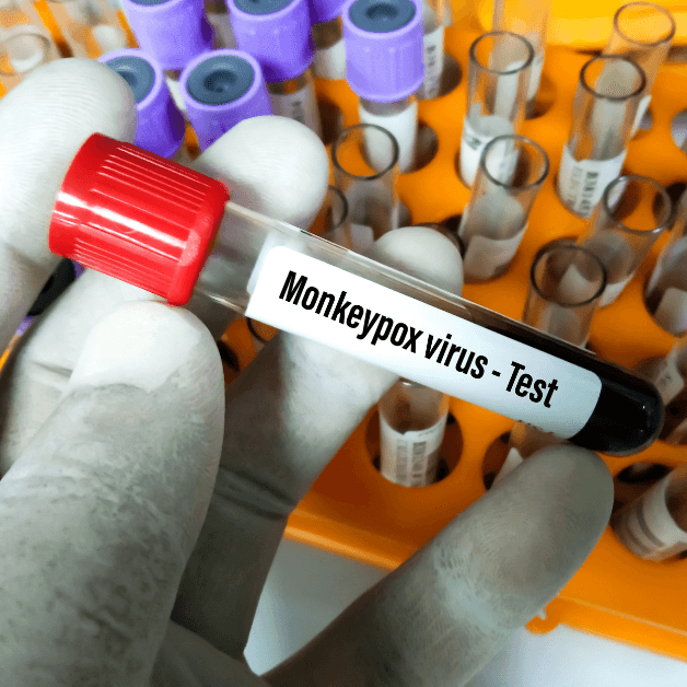 Malaysia's Plan To Manage Monkeypox