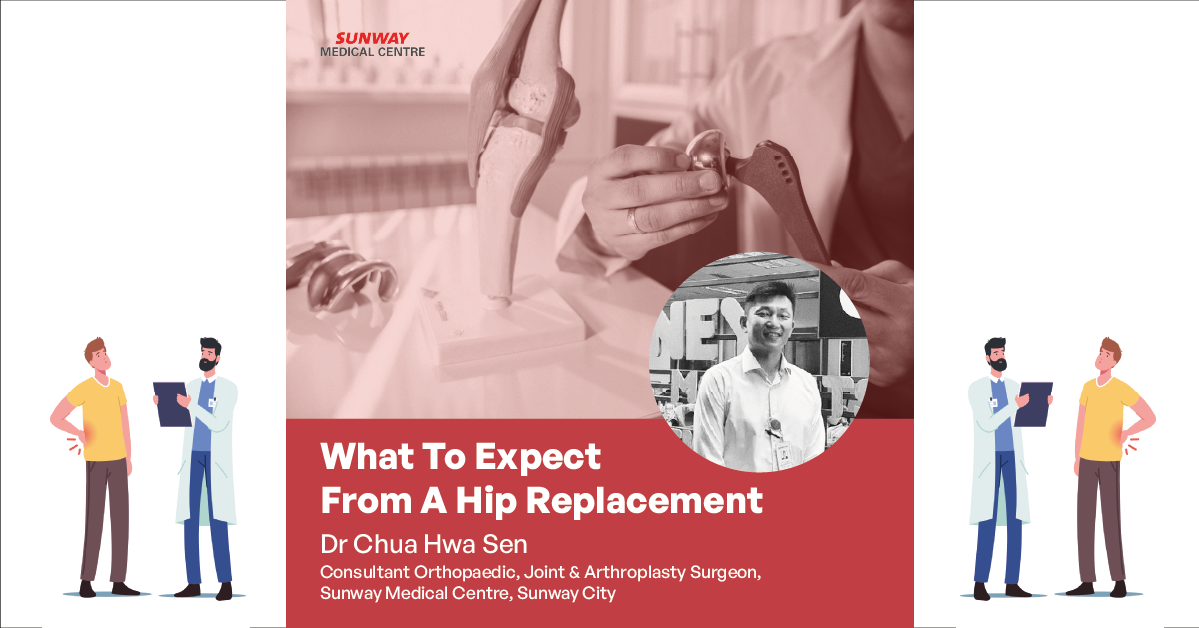 What To Expect From A Hip Replacement