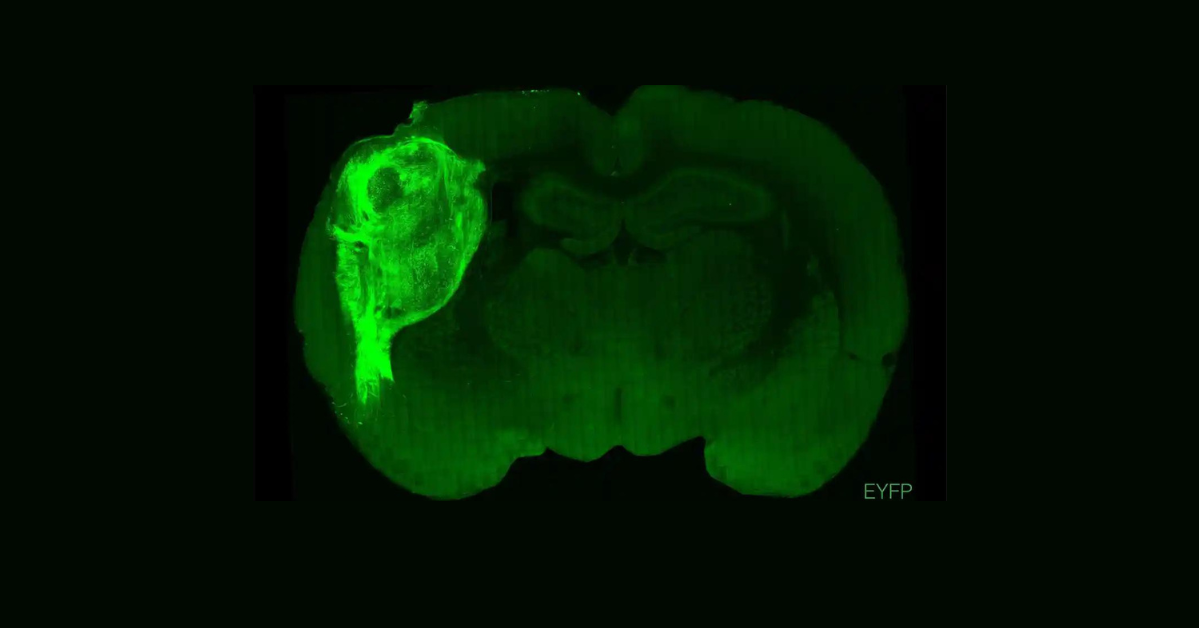 Brain Waves: Why Are Scientists Transplanting Human Neurons into Rat Brains?