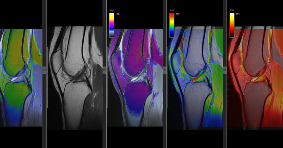 Should We Use ChatGPT in Orthopaedics?