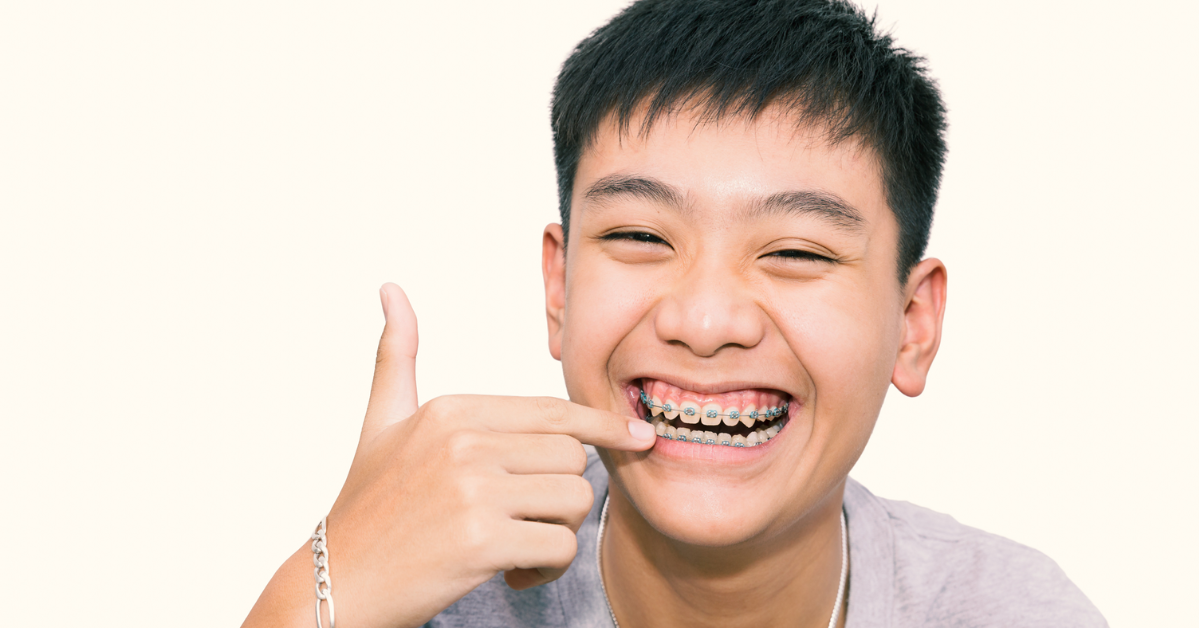 Doctor in the House: 101 on Braces and Aligners