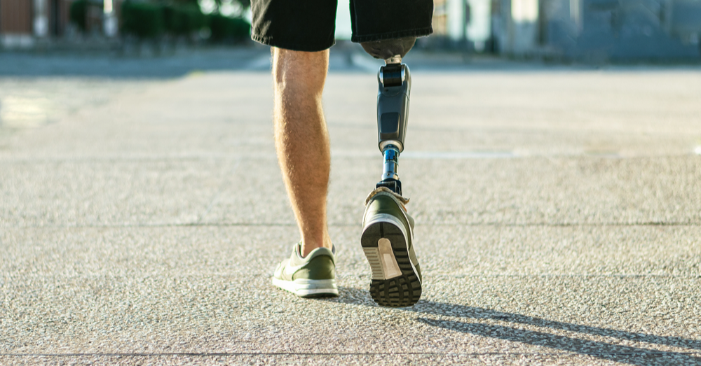 Adapting to Prosthetic Limbs