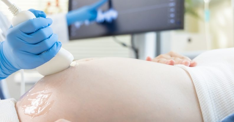  Pregnancy Ultrasound Packages: Scan or Scam?