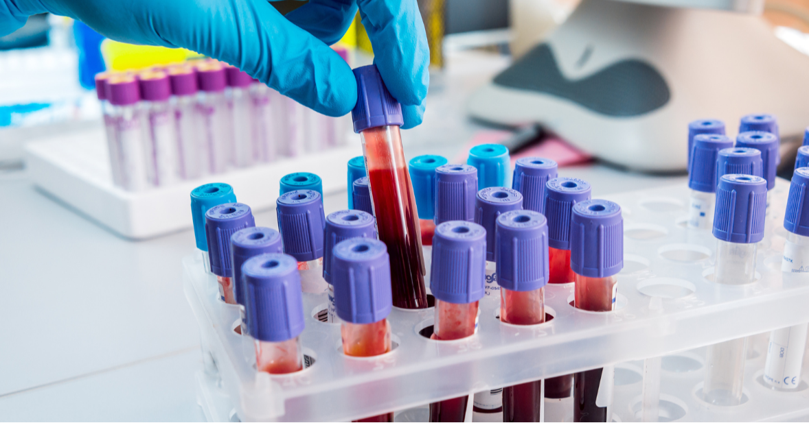 Will This Test Tell Me If I Have Cancer?