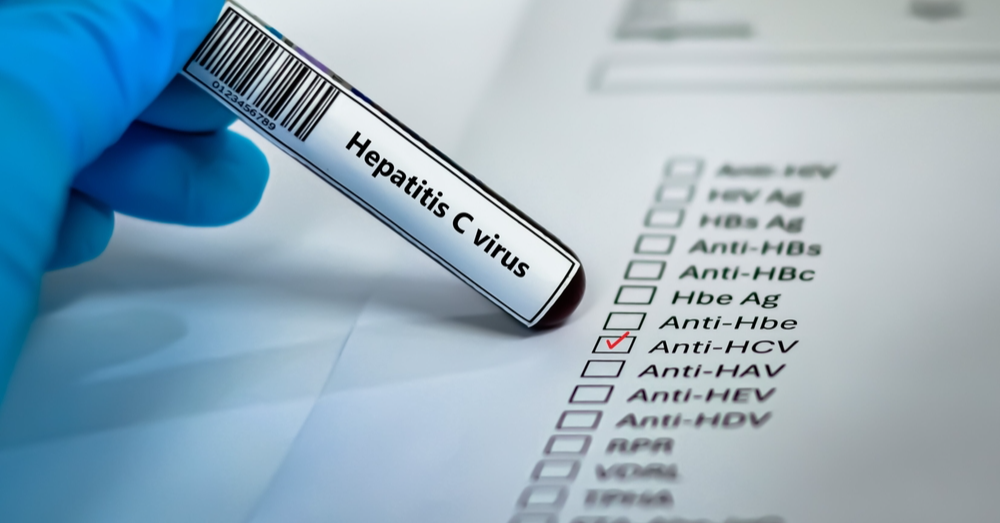 Malaysia’s Progress in Treating Hepatitis C