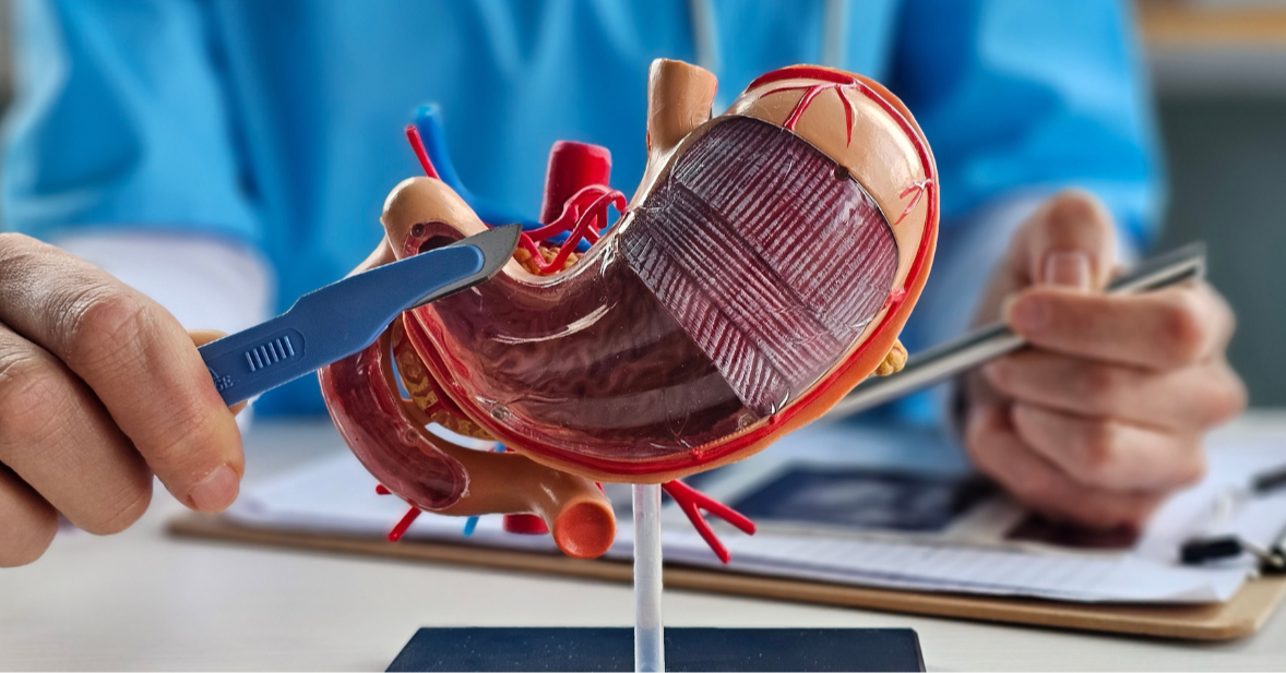 Bariatric Surgery Is Changing