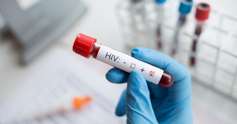 Top 5 At 5: Rising HIV Cases Among Tertiary Students